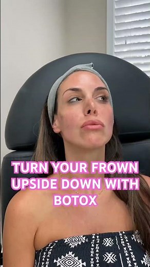 Botox lip flip and DAO muscle #botox #lipflip #botox101 #botoxeducation