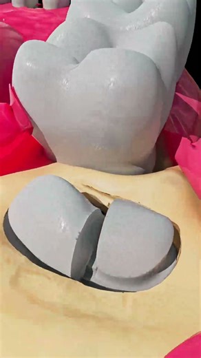 Wisdom Tooth Extraction