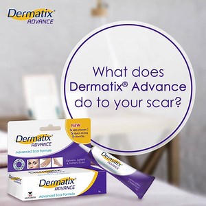 10K views · 101 reactions | Wonder how Dermatix® Advance helps you manage your scar? Find out more and begin your own scar healing journey today! | Dermatix Malaysia | Facebook