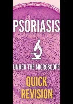 Psoriasis Under the Microscope 🔬 | Quick Histopathology Revision for Medical Students 🧬