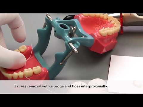 3M RelyX Universal Cement Video "How to self adhesive cementation",
