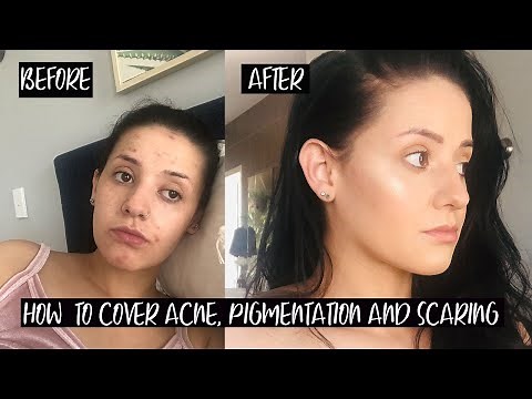 HOW TO COVER SCABS ON FACE WITH MAKEUP/ TOO FACED MULTI-USE SCULPTING CONCEALER