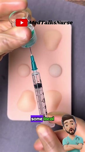 Why You Should NEVER Squeeze an Abscess Yourself! 🛑🏥 |MedNurseTalk #medicaleducation #ClinicalSkills