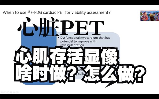 【心肌存活显像】When and How to perform Cardiac PET to Detect Myocardial Hibernation