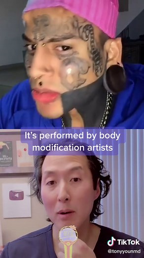 Exploring Extreme Body Modification Procedures