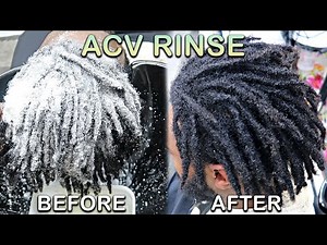 My First ACV RINSE on DREADLOCKS | How To WASH LOCS (Starter Locs Journey)