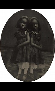209K views · 8.1K reactions | Conjoined Twins Millie and Christine #facts #ancestry #historylovers #familytree #history #genealogy #familyhistory #historymatters | Find My Family | Facebook