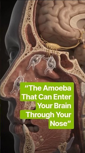 The Amoeba That Can Enter Your Brain Through Your Nose #naegleriafowleri #braineatingamoeba #PAM