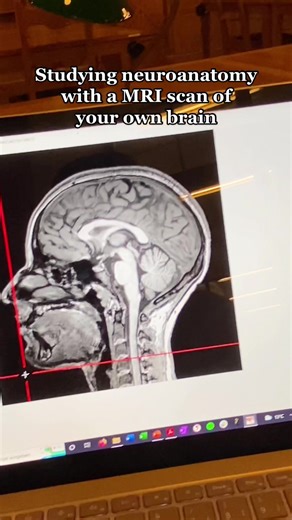 Exploring Neuroanatomy: Textbooks vs. MRI Scan