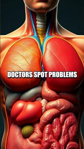 MRI Machines Demystified