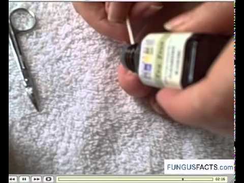 Nail Fungus Treatment Guide For Topical Application