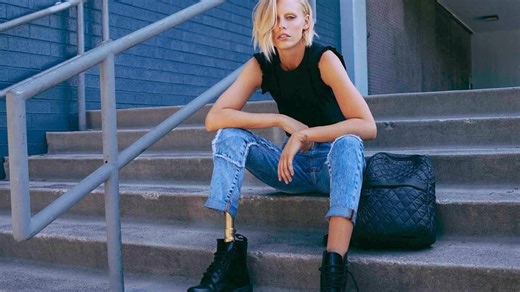 Toxic Shock Syndrome From Tampon Use Leaves Model Fighting for Her Life