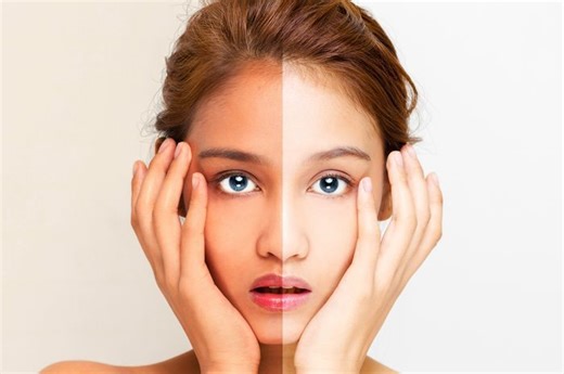 Sunscreen dan Sunblock Mirip, Fungsi dan Kandungan Aktifnya Berbeda | Grid Health