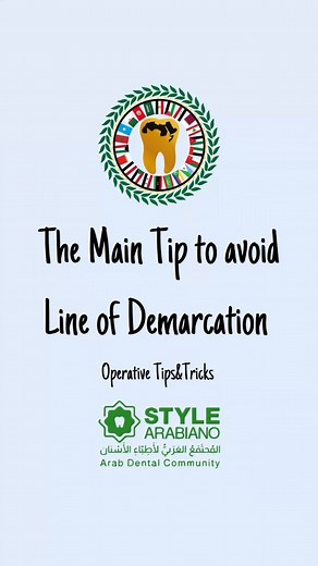 The main tip to avoid line of demarcation in class IV Operative Tips&Tricks Credit @dr.gaserdentalclinic #stylearabiano #styleaeabianoteam #Operative #classIV | Style Arabiano