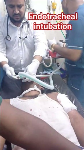Endotracheal intubation in emergency department