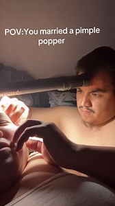 POV: You Married a Pimple Popper — Funny Blackhead Popping Moment