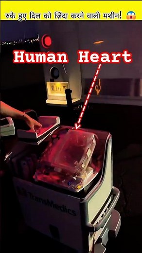 This Machine Brings a Dead Heart Back to LIFE! 😱 1M #shorts #viral