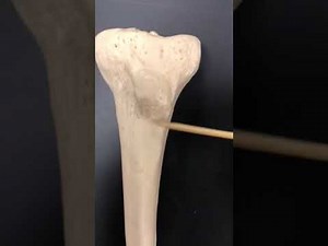 The Tibia and Fibula