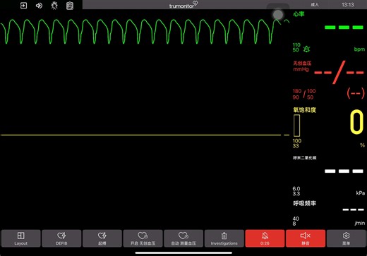 trumonitor心电监护模拟部分波形