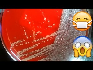 Strep/Respiratory & Urine Bacterial Culture