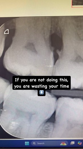 22K views · 74 reactions | Be a master of using hand instruments!!! I...