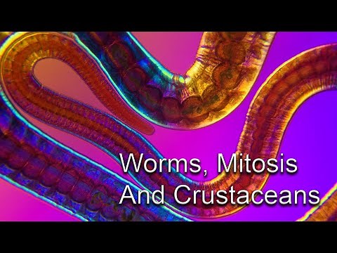 Five Different Organisms - Under The Microscope