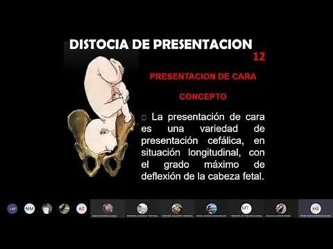 III Fase 5º Clase teórica Distocias de presentación cefálicas deflexionadas cara frente y bregma