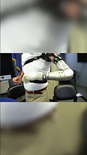 Enhancing Lives with "LUKE" Arm Prosthesis #robot #prosthetics #technology