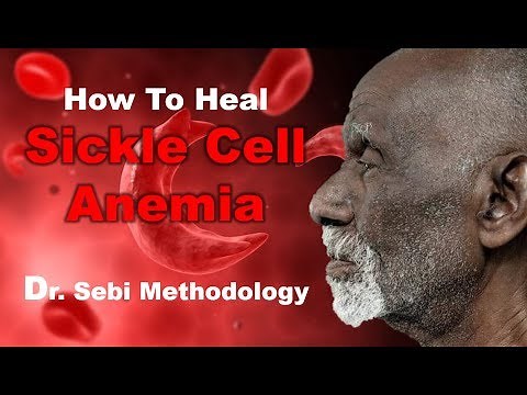 Heal Sickle Cell Anemia - Dr. Sebi Methodology