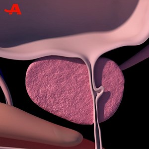 179K views · 58 reactions | Symptoms of prostate cancer usually don't appear until the disease has advanced. Get regular screenings and share this video with someone you care about to help spread the word on this cancer's subtle signs. | AARP | Facebook