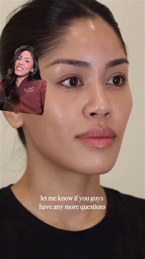 Dawn, RN BSN | Bay Area Injector + Beauty Creator on Instagram: "One of my favorite treatments, and can you blame me?! Some key reasons: - safe for all skin types - minimal recovery - smoother, glowier, more even skin ✨ 📱TO BOOK 📍Tala Aesthetics @welcometotala | Walnut Creek, CA: visit our website at www.talaaesthetics.com | (925) 397-8911"