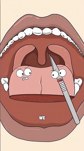 His Tongue Was Removed Then Rebuilt. #short