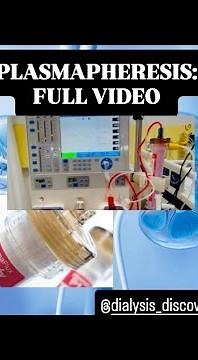 how to do plasmapheresis procedure?#Dialysis_info