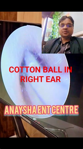 FOREIGN BODY ( COTTON BALL ) IN RIGHT EAR #shorts #youtubeshorts #publicawareness #doctor