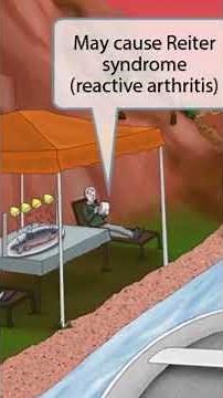 Salmonella Species — Recognize the patterns before the question gives it away