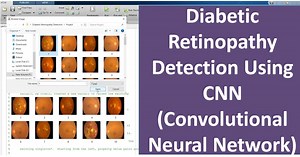 Diabetic Retinopathy Detection Using CNN Convolutional Neural Network Matlab Project With Source Code | IEEE Based Project