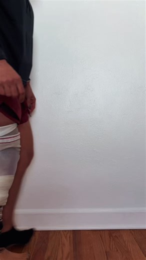 making progress on getting a new leg!!! Part 3 of this series is now live on YouTube 😅 #prostheticleg #amputeelife #limbloss | Adaptive Amputees