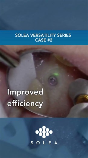 Solea® Versatility Series Case 2: Implant Uncovery