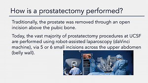 VIDEO: Localized Prostate Cancer: Surgery - 2021 Prostate Cancer Patient Conference