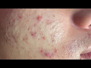 Satisfying Relaxing with Huong Da Nang Video #265