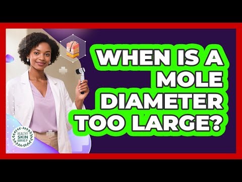 When Is A Mole Diameter Too Large?