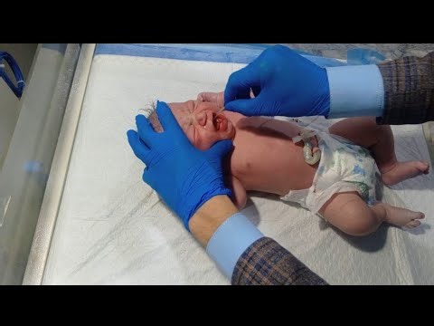 Newborn Baby After Birth | Initial Care of Newborn | Essential Newborn Care Steps