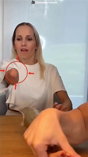 This girl has a unique metal hand 😱 #fact