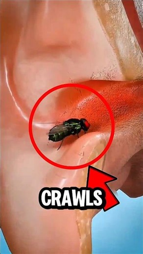 If a Bug Crawls Into Your Ear, Don’t Do THIS! 😳