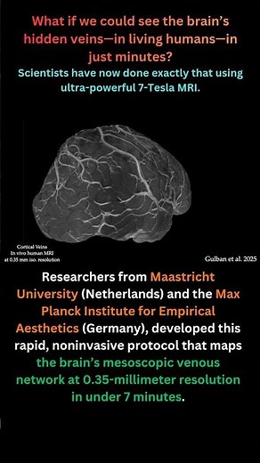 Whole-Brain Vein Mapping in Minutes: Fast 7-Tesla MRI Reveals Human Brain Microvasculature