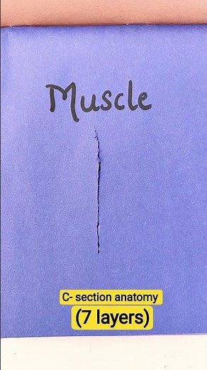 C- section anatomy - 7 layers - cesarean anatomy - medtalks