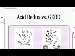 Acid Reflux vs GERD Explained — Before It Turns Into Something Serious