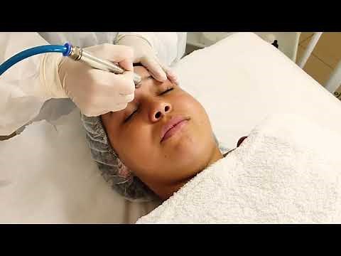 Passo a Passo do Peeling de Diamante