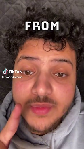 Why Do Clear Cases Turn Yellow? Tips to Clean Yellow Phone Case