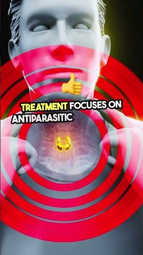 Amoebic Liver Abscess: Causes, Symptoms, & Treatment Explained